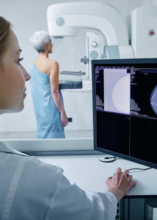 Mammography