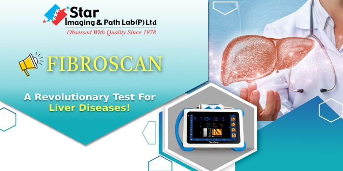 liver fibroscan