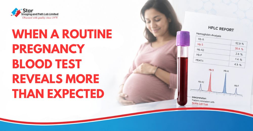 A Routine Antenatal Investigation That Revealed an Inherited Blood Disorder