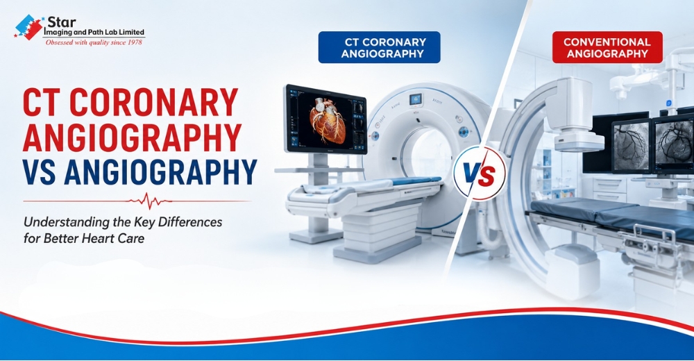 CT Coronary Angiography vs Angiography