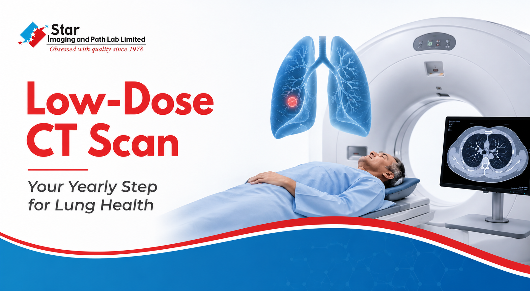 How Often Should You Get a Low-Dose CT Scan?