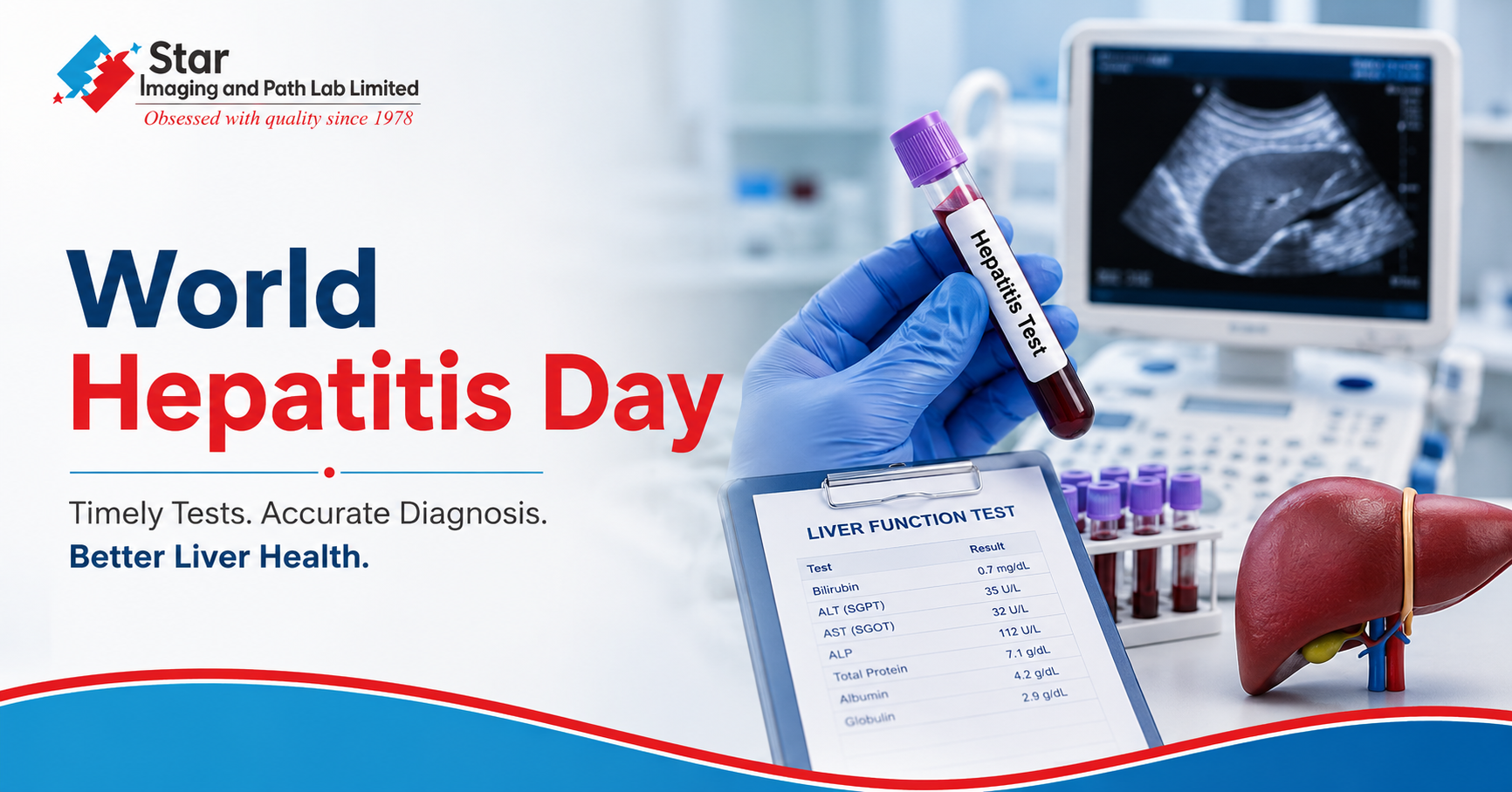 Hepatitis Testing in Delhi: When Should You Get Tested?