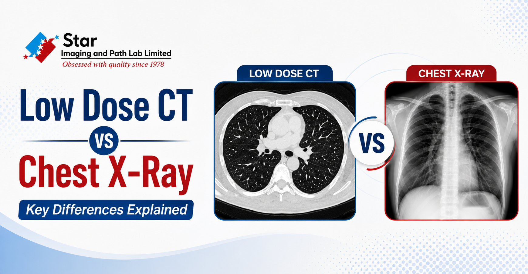Low Dose CT vs Chest X-Ray: Key Differences Explained