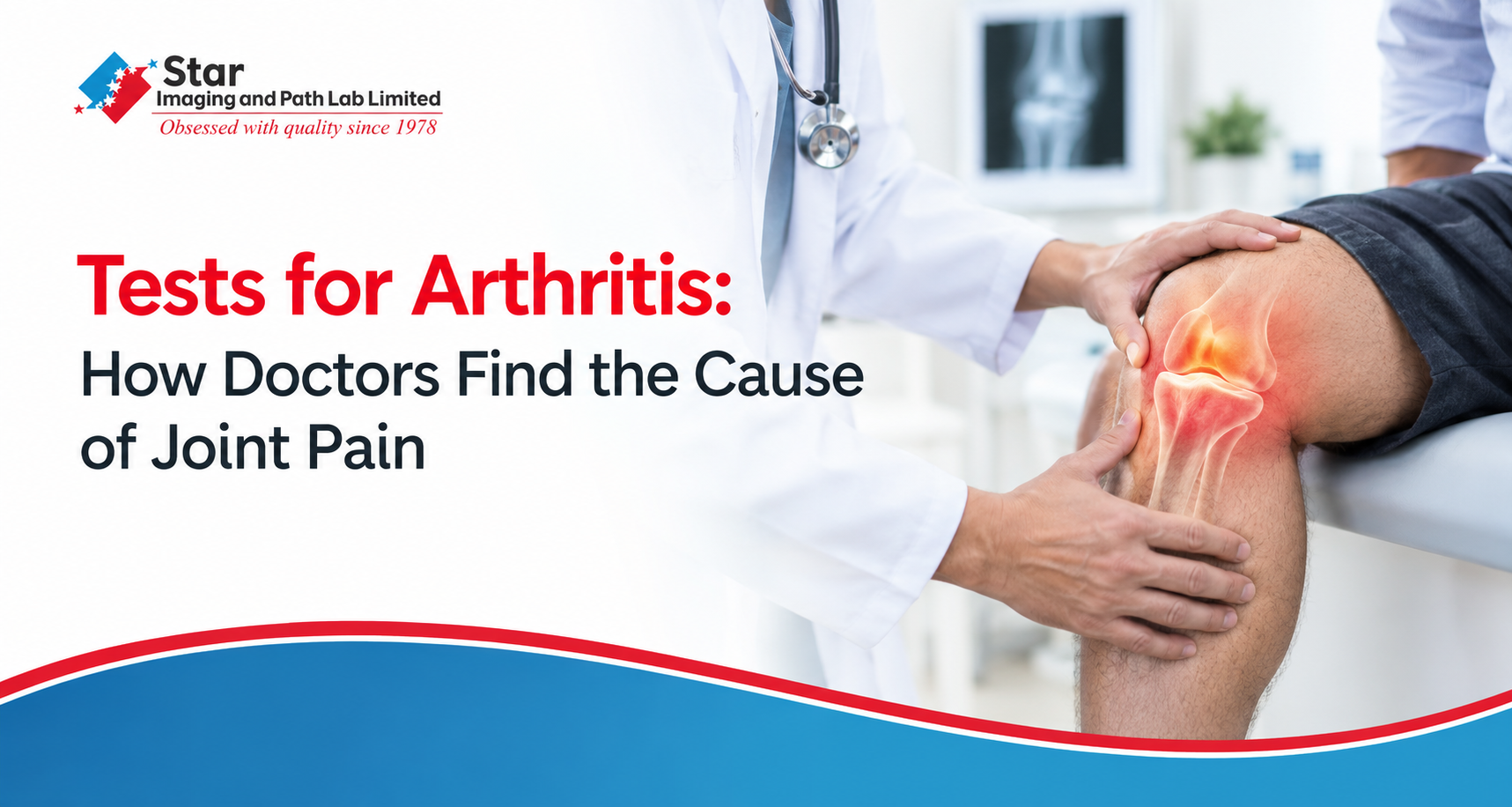 Tests for Arthritis: How Doctors Find the Cause of Joint Pain