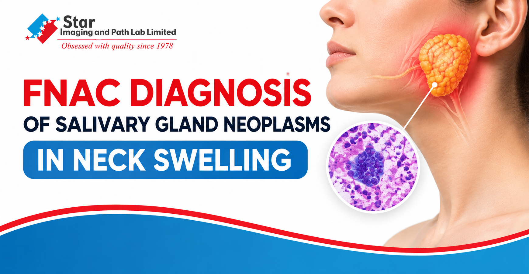 Neck Swelling in a 16-Year-Old: A Case of Pleomorphic Adenoma