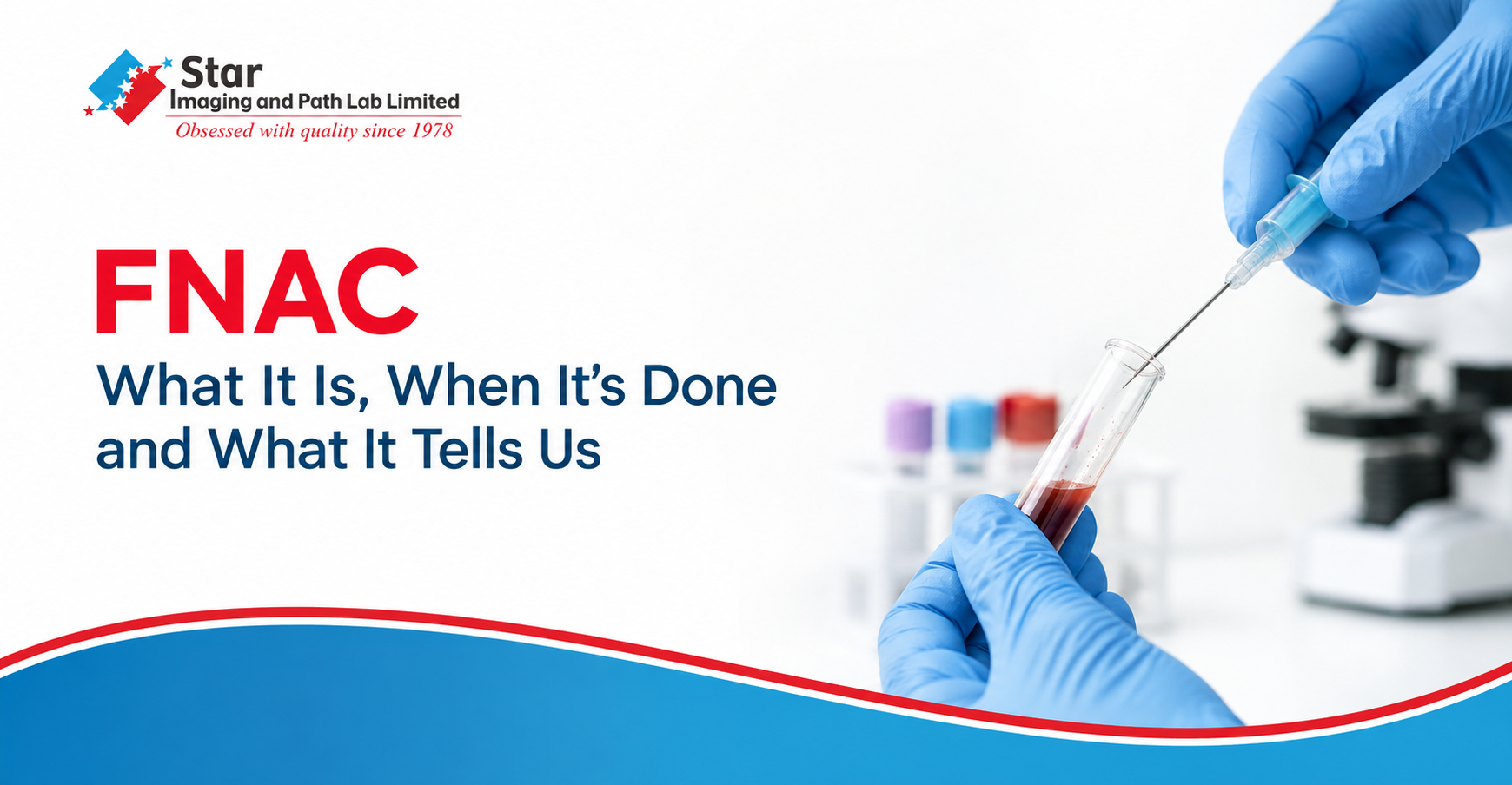 FNAC Test: What It Is, How It Is Done, Uses, Preparation and Results