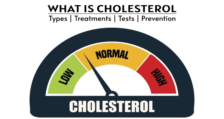 What is Cholesterol: Types, Tests, Treatments, Prevention