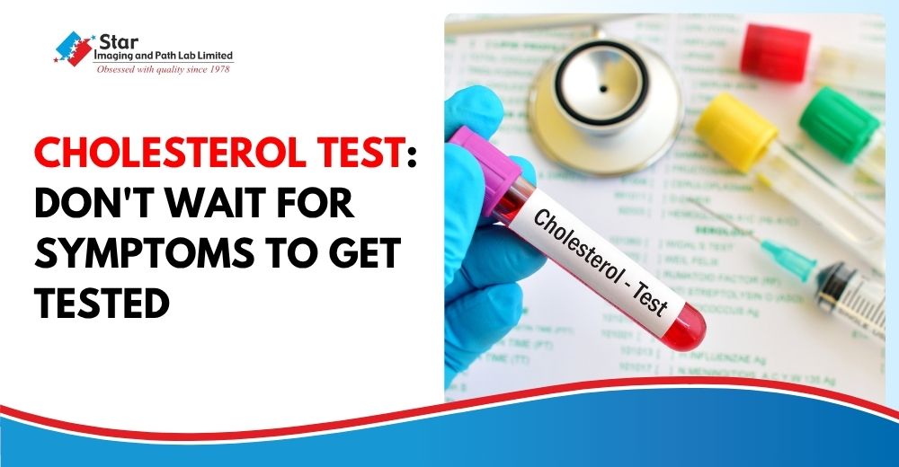 Cholesterol Test Guide: How Often Should You Check It? More Often Than Most People Think