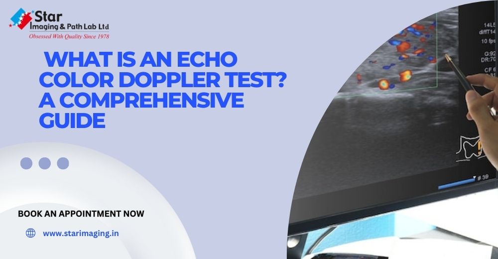 What Is an Echo Color Doppler Test? A Comprehensive Guide