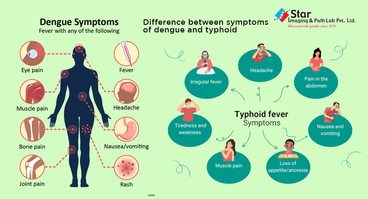 Difference between symptoms of dengue and typhoid: Know their symptoms and prevention tips from the doctor.