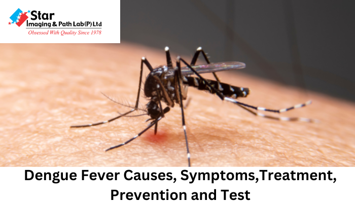Dengue Fever Causes, Symptoms,Treatment, Prevention and Test