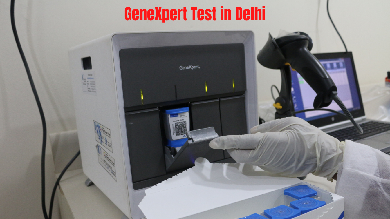 Why Select a Professional Service Provider for the Genexpert Test?