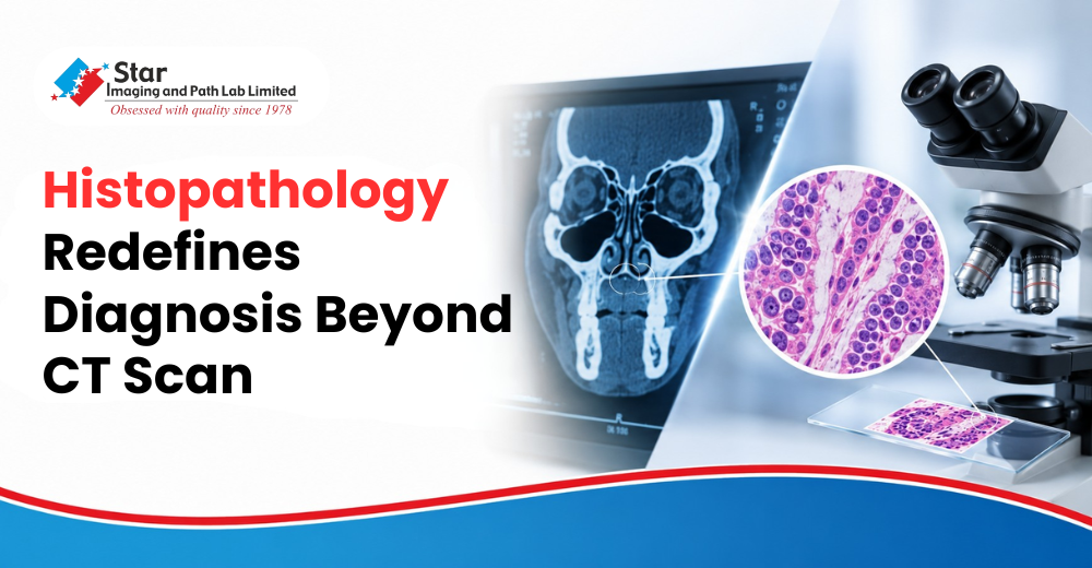 Histopathology Redefines Diagnosis Beyond CT Scan