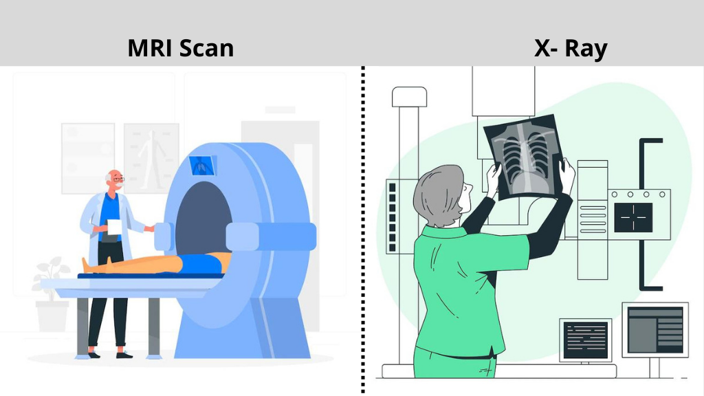 What is an MRI scan? Is It Better To Choose MRI Over X-Rays?