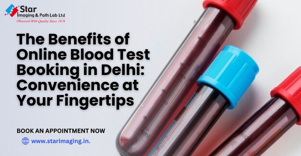 The Benefits of Online Blood Test Booking in Delhi: Convenience at Your Fingertips