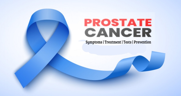 Prostate Cancer- Its Causes, Symptoms, Treatment and Prevention
