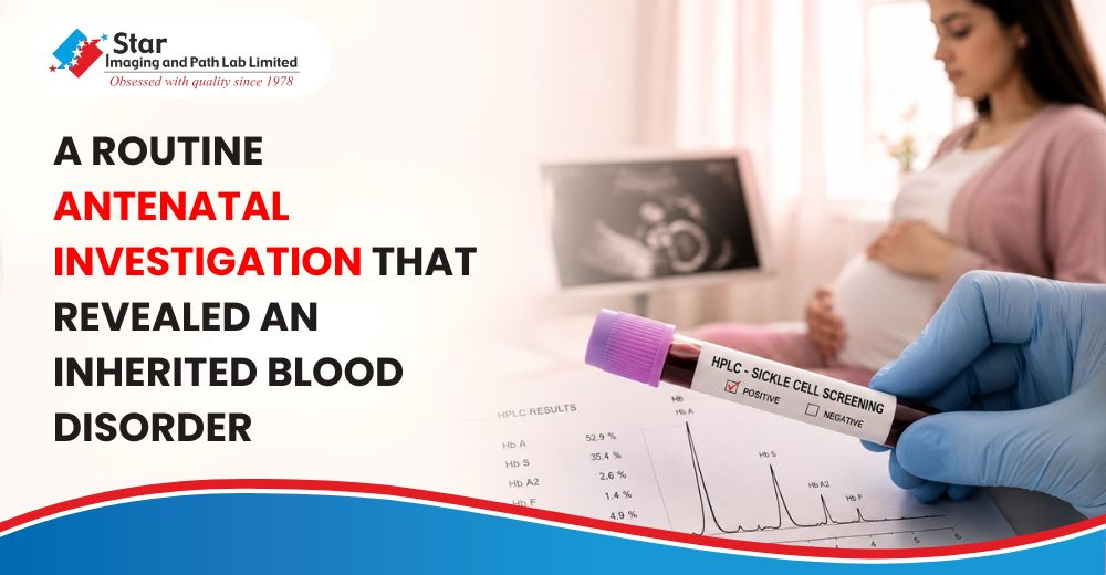 A Routine Antenatal Investigation That Revealed an Inherited Blood Disorder