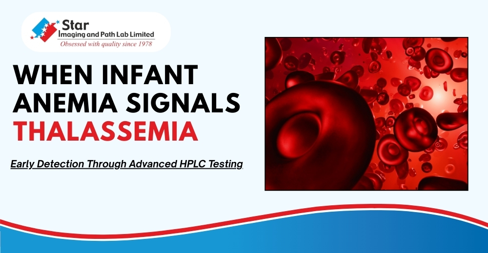 Early Detection of Thalassemia Major in Infant, Age 10 Months: Dr. Shashirekha’s Expertise with HPLC at Star Imaging