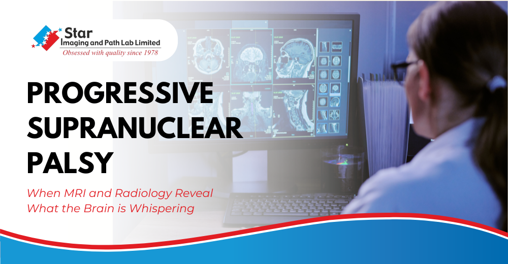 Decoding PSP: When MRI and Radiology Reveal What the Brain is Whispering