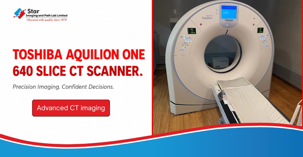 Toshiba Aquilion ONE 640 Slice CT Scanner at Star Imaging Delhi