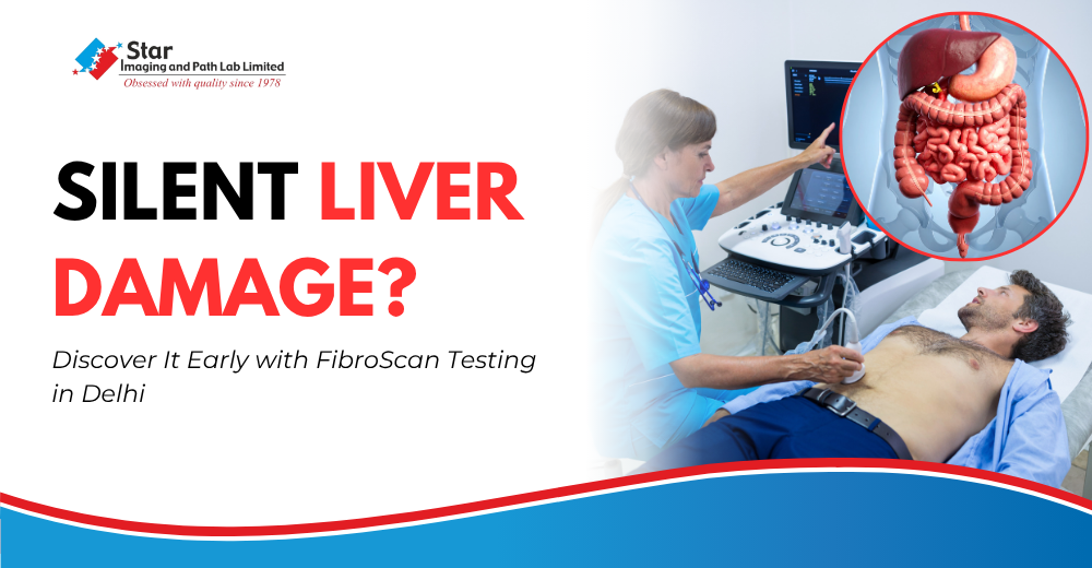Silent Liver Damage? Discover It Early with FibroScan Testing in Delhi