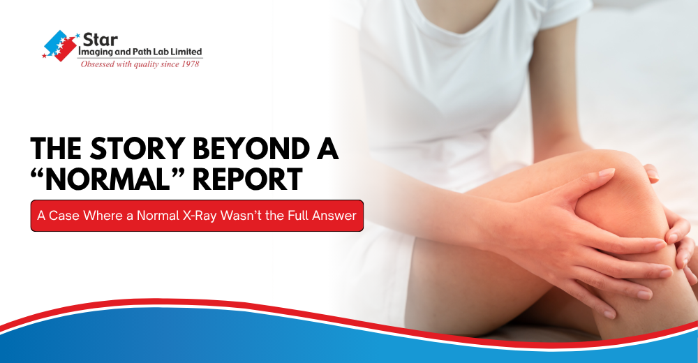 When a Normal X-ray Didn’t Explain Mrs. Sharma’s Knee Pain