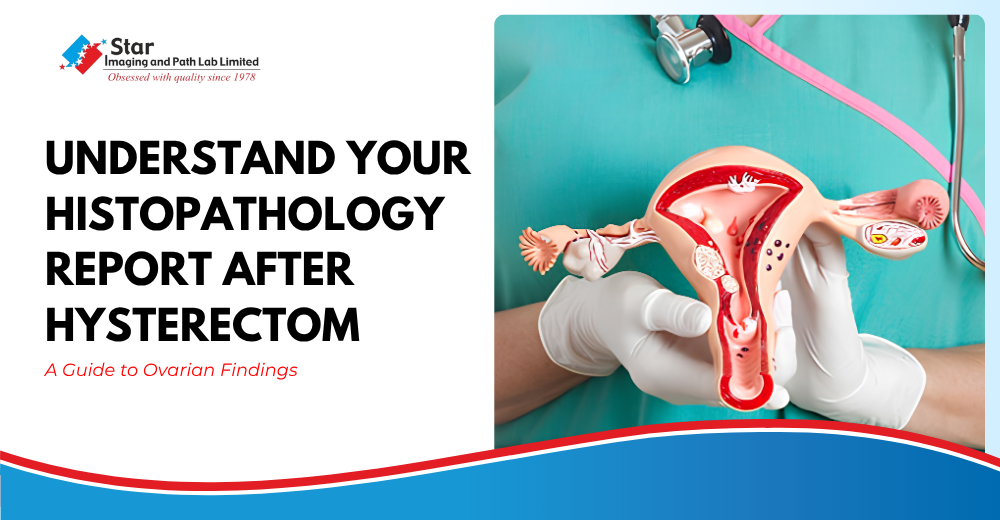 How to Understand Your Histopathology Report After Hysterectomy: A Guide to Ovarian Findings