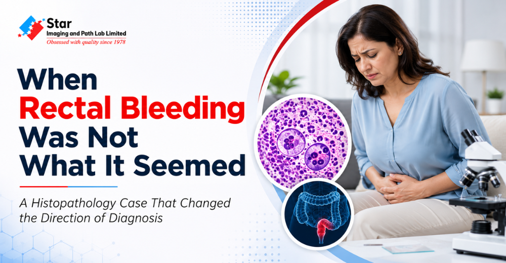 Rectal Bleeding in a 59 Year Old Woman Revealed an Unexpected Amoebic Infection | Histopathology Case Study