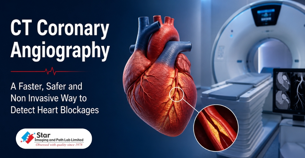 CT Coronary Angiography: A Faster, Safer and Non Invasive Way to Detect Heart Blockages