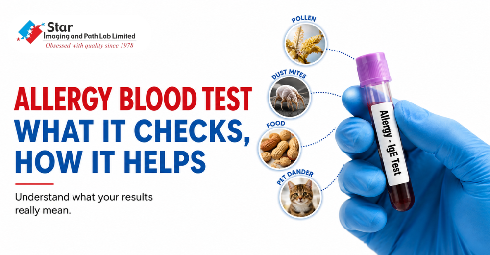 What Does an Allergy Blood Test Measure?