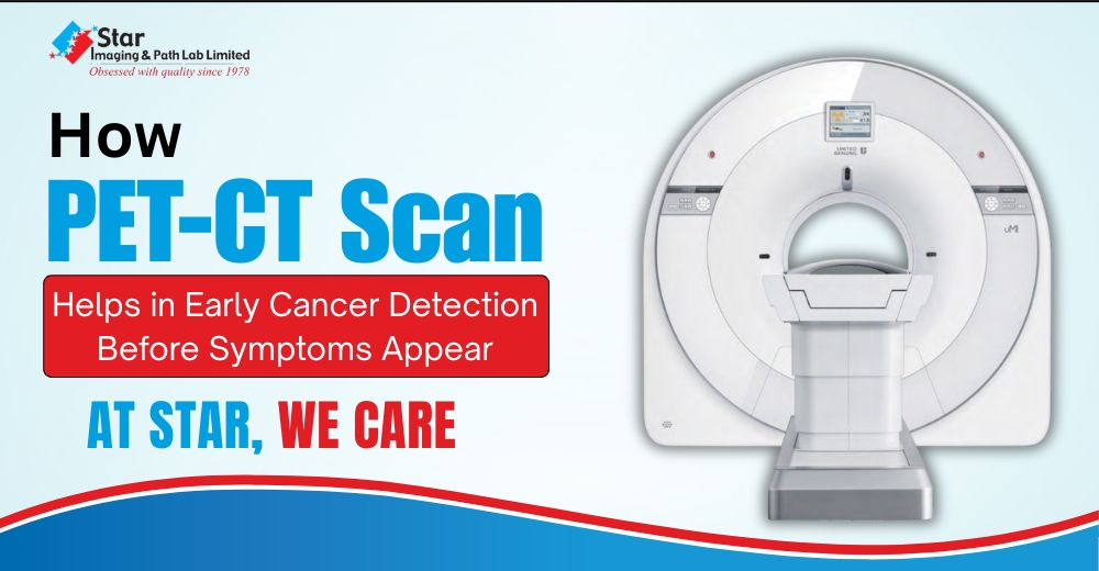 How PET-CT Scan Helps in Early Cancer Detection Before Symptoms Appear