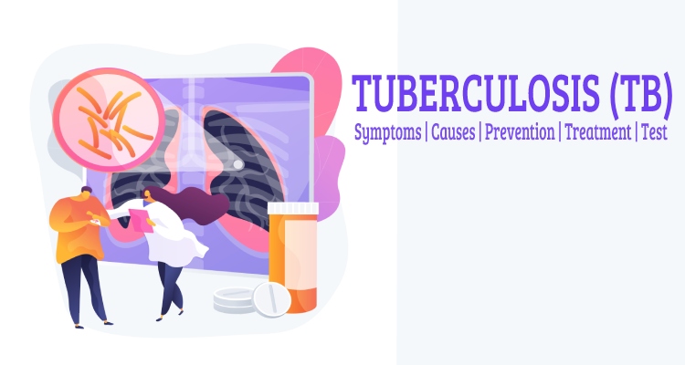 What Is Tuberculosis and Its Symptoms, Causes, Treatment, Prevention, Test