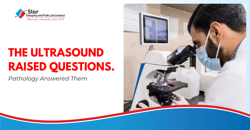 The Ultrasound Raised Questions. Pathology Answered Them