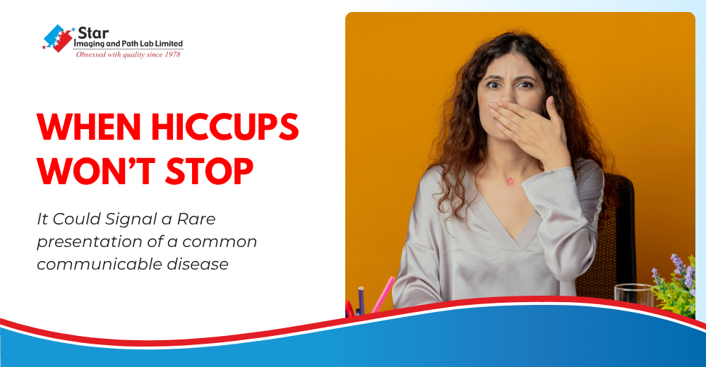 Persistent Hiccups: When Hiccups Signal an Unusual Case of TB