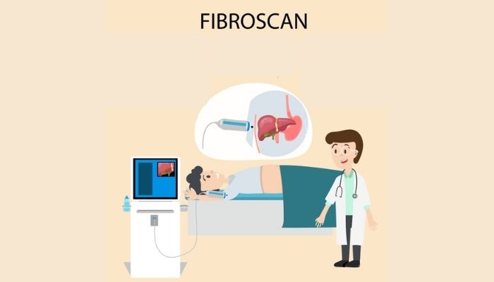 What Makes Us The Best For Fibro Scan Liver Test In Delhi?