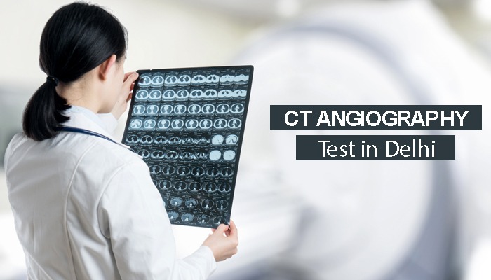 The Usefulness of Having a Ct Angiography Test in Delhi; Book You Now.