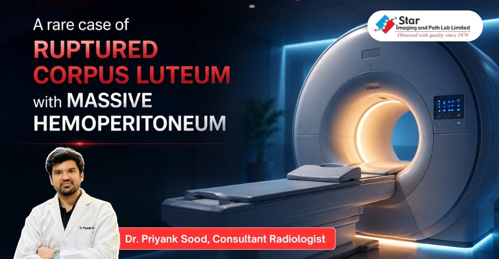 When an Ovarian Cyst Became a Surgical Emergency: A Radiologist's Perspective on a Rare Clinical Presentation