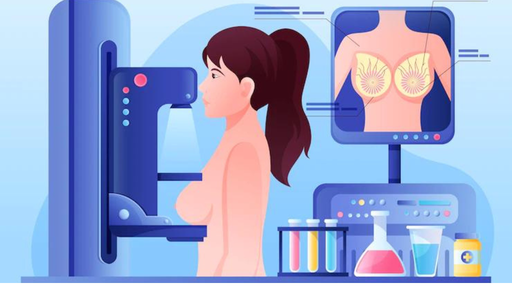 Mammography Tests- A Complete Guide